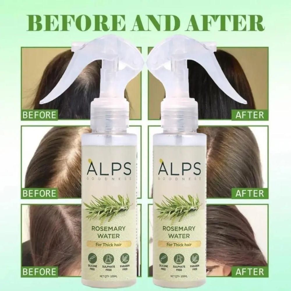 Alps Rosemary Water | Hair Spray for Regrowth (Pack of 3)